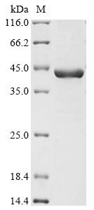 Leishmania chagasi Guanine nucleotide-binding protein subunit beta-like Protein