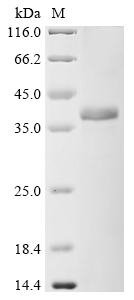 Human Complement component C9 Protein