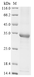 Human HPRT1 Protein