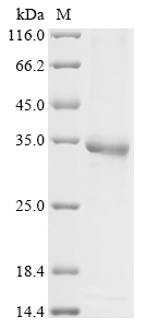 Human HPRT1 Protein