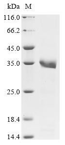 Human HPRT1 Protein