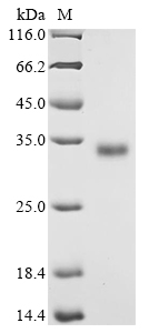 Human HPRT1 Protein