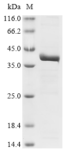 Mouse Eef2kmt Protein