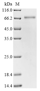 Human SMPD3 Protein