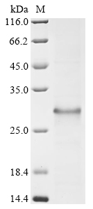Blomia tropicalis Major allergen Blo t 12 Protein