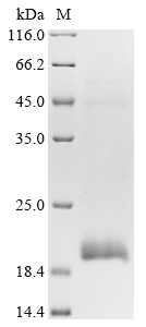Human CCR1 Protein