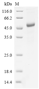 Human ACTL6B Protein
