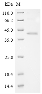 Human ADGRG6 Protein