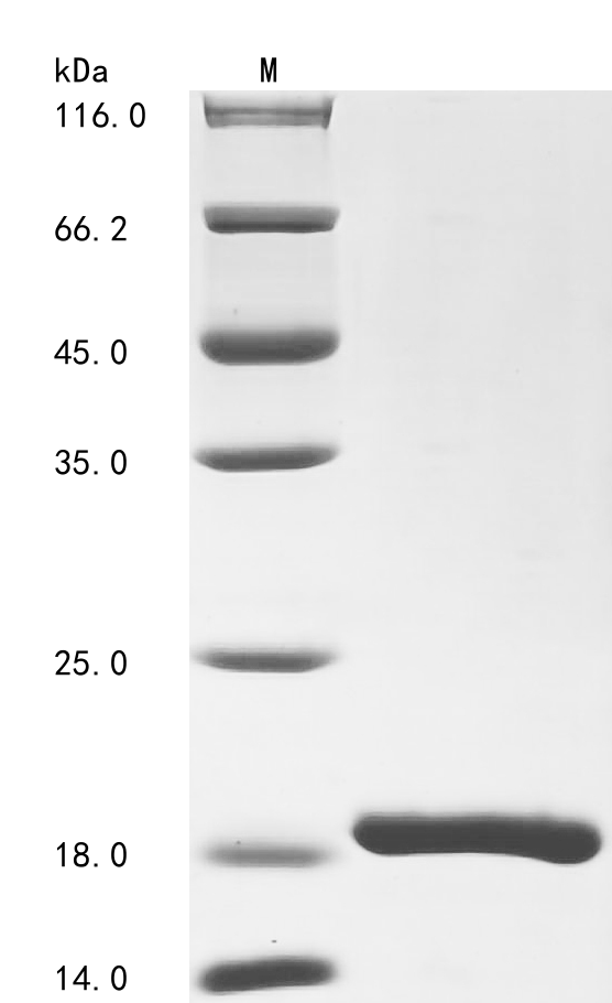 Human GABARAP Protein