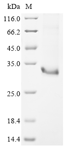 Mouse Ush2A Protein
