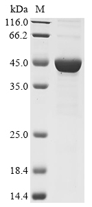 Lymphocytic choriomeningitis virus Nucleoprotein Protein