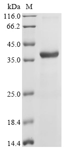 Sandfly fever sicilian virus Non-structural protein NS-S Protein