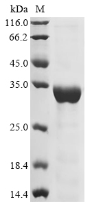 Mouse NAD-dependent protein deacetylase sirtuin-3 Protein