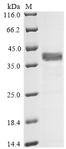Human Complement component C9 Protein