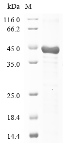Human LRRC17 Protein