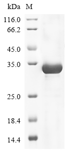 Human KAL1 Protein