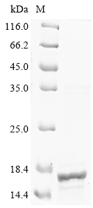 Human CD81 Protein