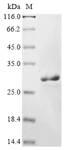 BK polyomavirus Small t antigen Protein
