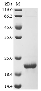 Neosartorya fumigata 60S acidic ribosomal protein P2 Protein