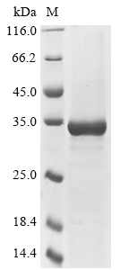 Semliki forest virus Non-structural polyprotein Protein