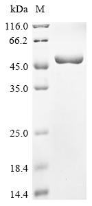 Human respiratory syncytial virus B Nucleoprotein Protein