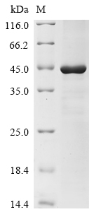 Porphyromonas gingivalis Lys-gingipain Protein