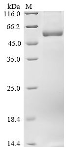 Human CYP7A1 Protein