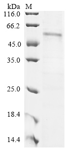 Human CCNB1 Protein