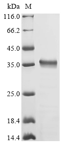 rgpB Protein