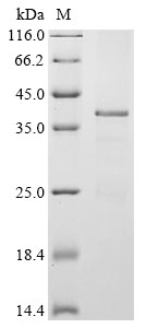 Mouse Twist1 Protein
