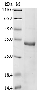 Human RAB33B Protein