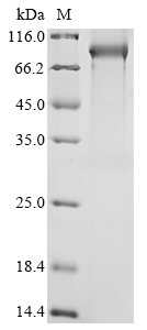 Mouse C1sb Protein