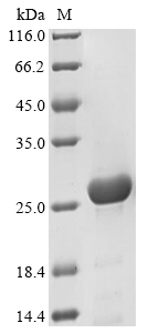 Chlamydia trachomatis Virulence plasmid protein pGP3-D Protein