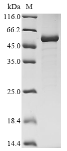 Bovine SERPINF1 Protein