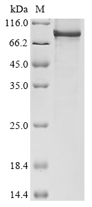 Human HHIPL1 Protein