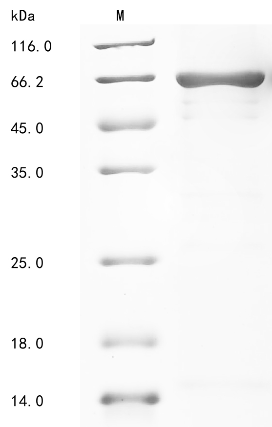 Human DPYSL4 Protein