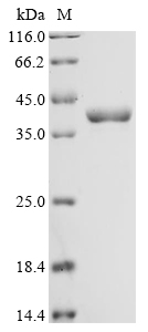 Pseudomonas aeruginosa Bifunctional protein FolD Protein