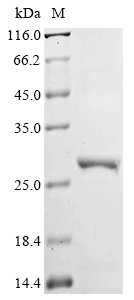 Human NR1H2 Protein