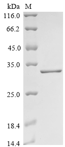 Human NR1H2 Protein