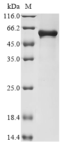 Human CALCOCO2 Protein