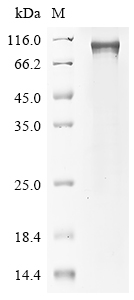 Mouse Rps6ka4 Protein