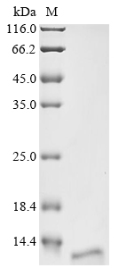 Human CT83 Protein