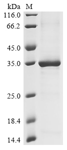 Dermatophagoides farinae Der f 9 allergen Protein