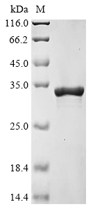 Mouse Ifi204 Protein