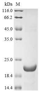 Human SRD5A2 Protein