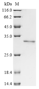 Human ELOA3DP Protein