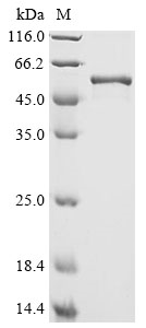Escherichia coli Guanosine-inosine kinase Protein