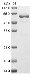 Dugbe virus Nucleoprotein Protein