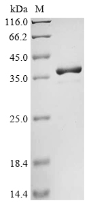 Sesamum indicum 11S globulin seed storage protein 2 Protein