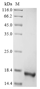 Human AMELY Protein